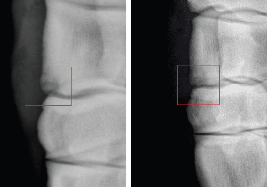OCD before and after, highlighted